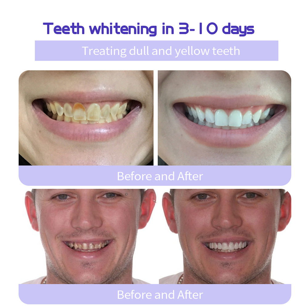 ODALIT™ TeethRestoration Mineral Powder🦷Obtain American Dental Association (ADA) Certification (Treats periodontitis and mouth ulcers, prevents tooth loss, and repairs gum recession)