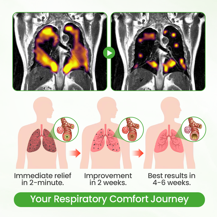 NEGUSY® Mulleaf Herbal Lung Purifier
