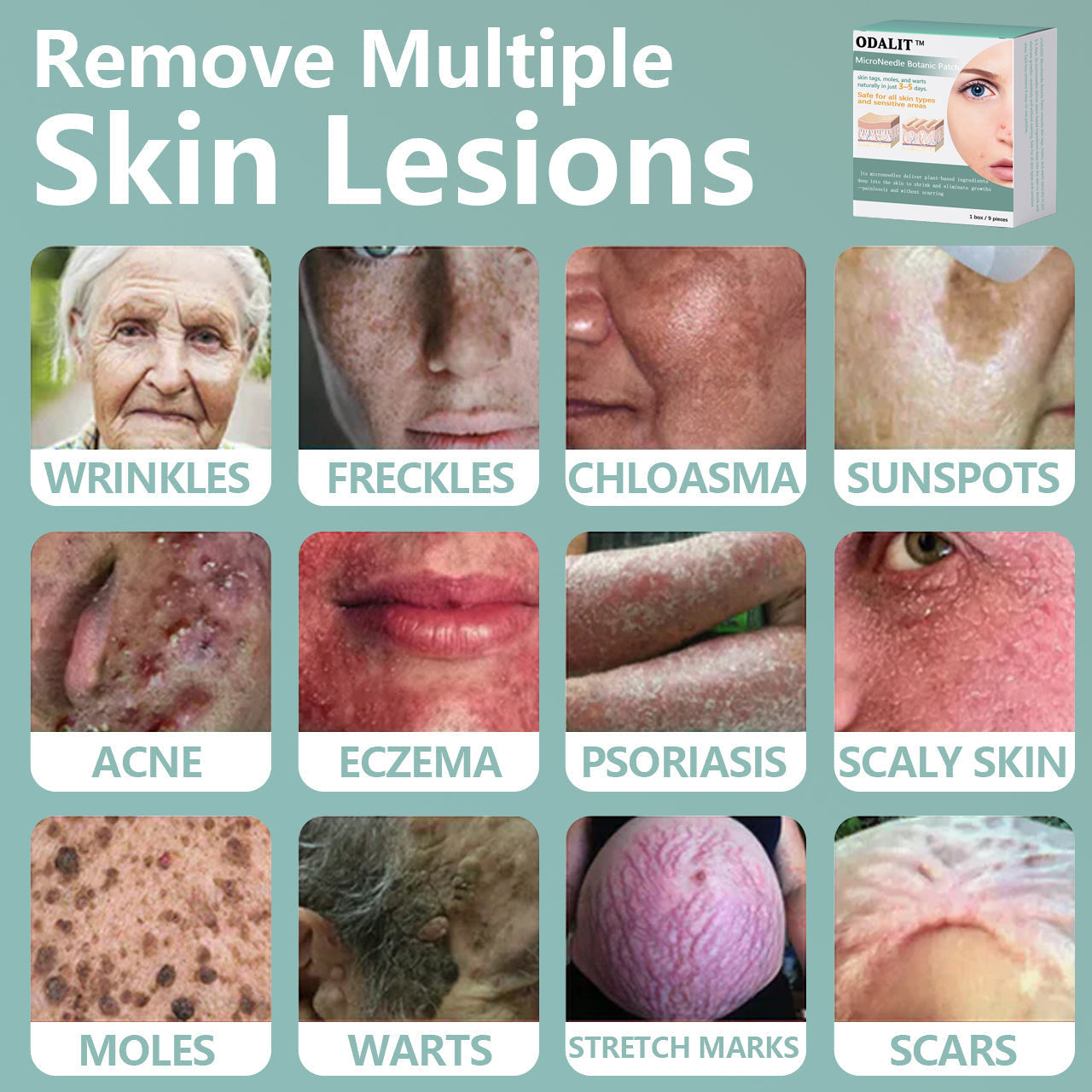 ✨ODALIT™ MicroNeedle Botanic skin Tag Removal Patch Made in the USA