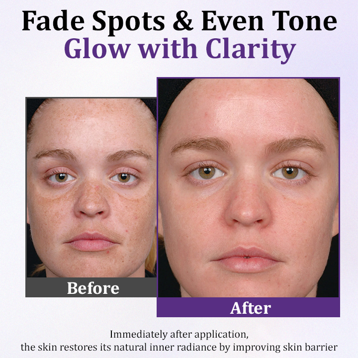 ODEIUN® PigmentaX ProFade Anti-Hyperpigmentation Cream