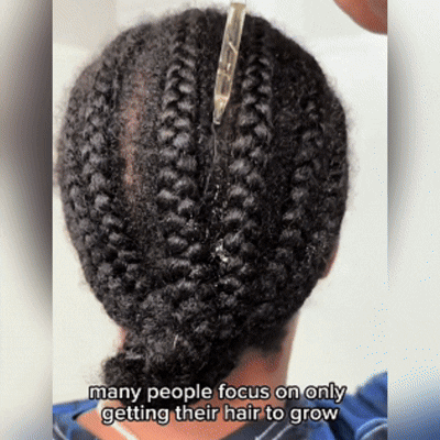 Jeremytis™ Hair Growth Oil