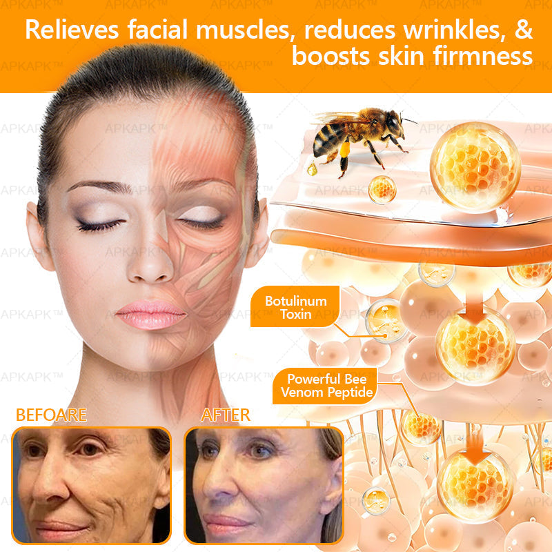 🎁Flash Sale - ODALIT™ Bee venom Comprehensive Cream🔥LAST DAY 80% OFF 💎💎