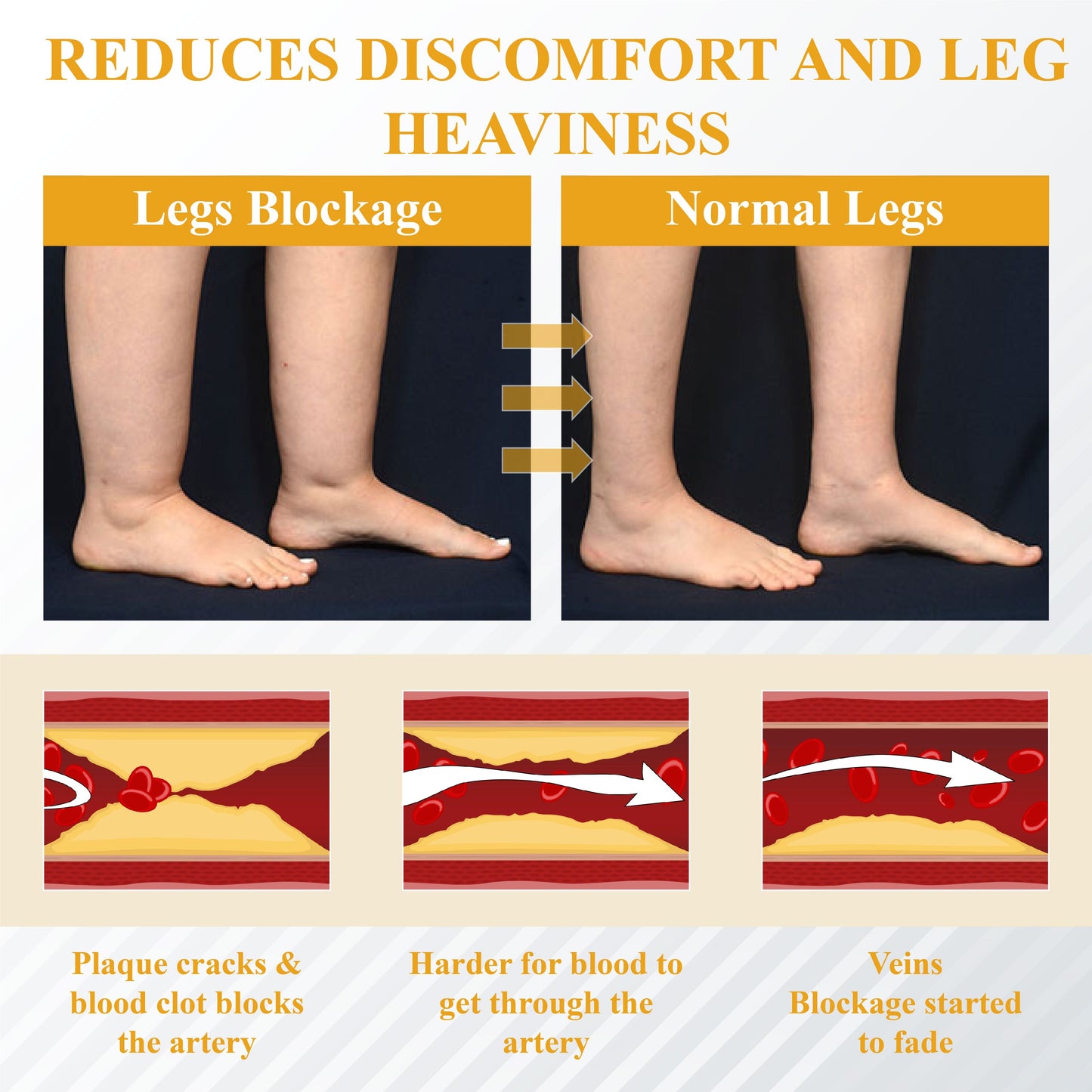 ODALIT® Bromelain Edema & Vein Care Cream
