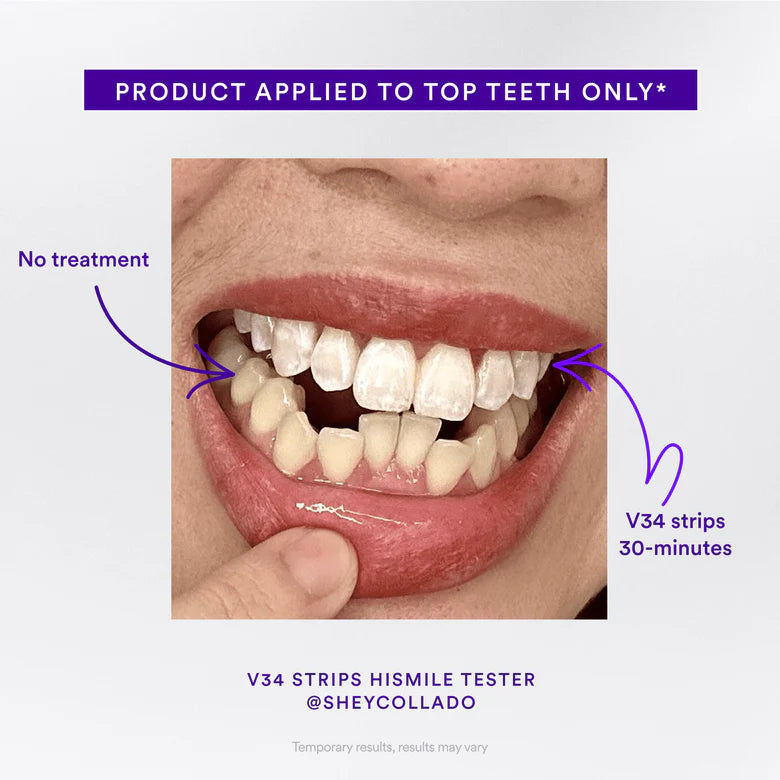 V34 Whitening Strips