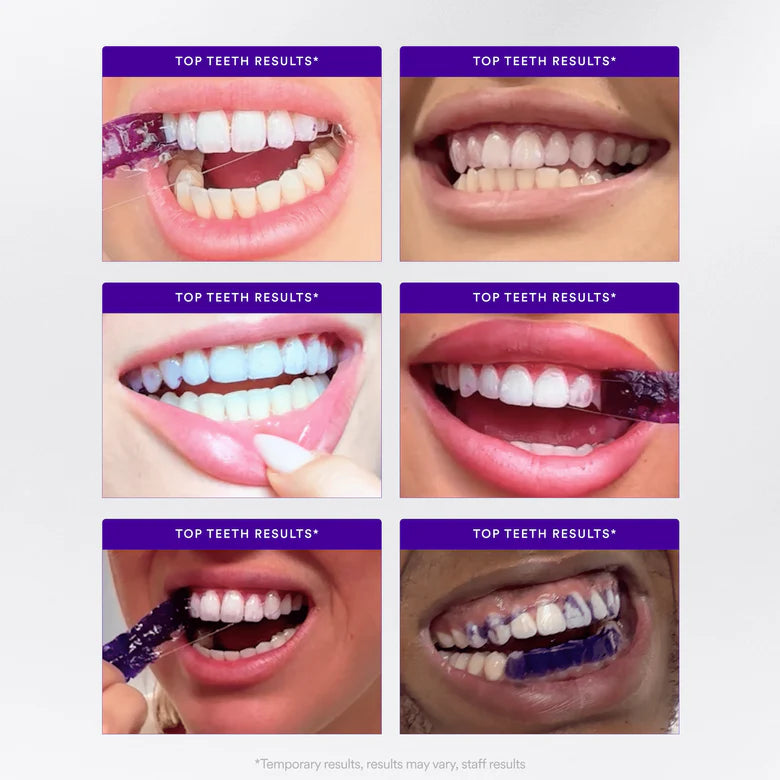 V34 Whitening Strips