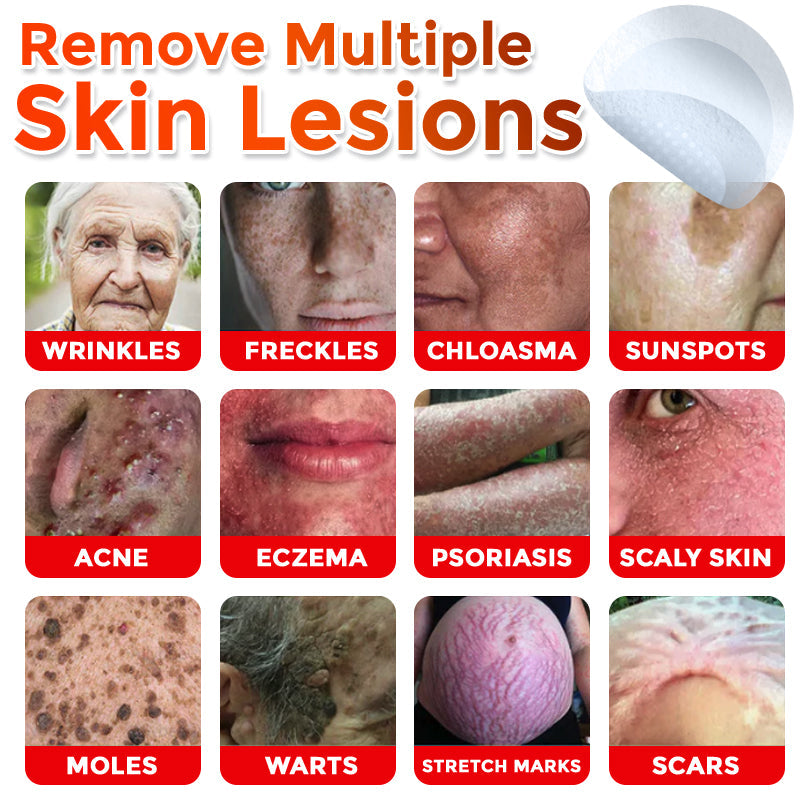 🌈MicroNeedle Botanic Skin Tag Removal Patch|Made in the USA