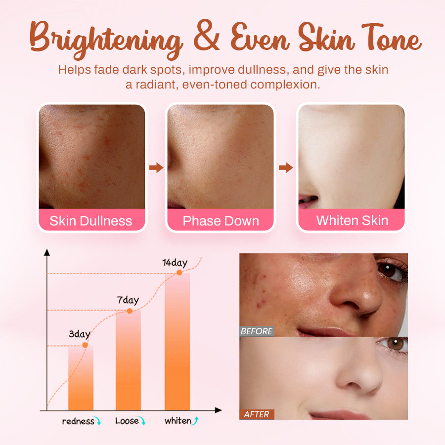 Whitening and Freckle - Removing Mask