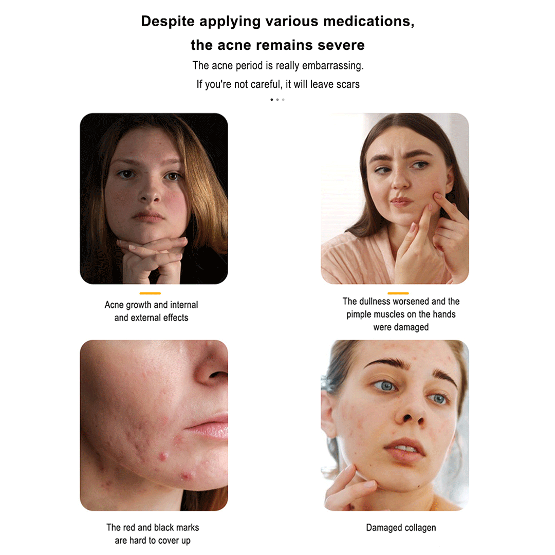 Jeremytis™ LED Acne Stickers