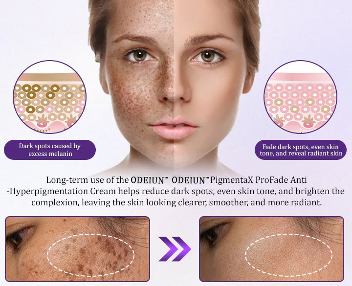 ODEIUN® PigmentaX ProFade Anti-Hyperpigmentation Cream