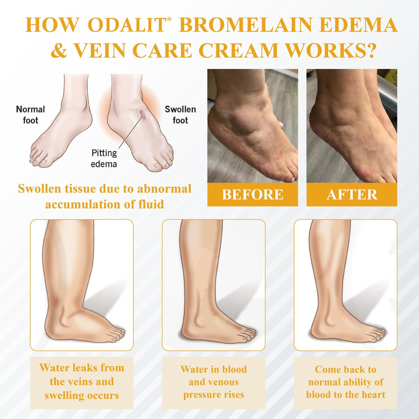 ODALIT® Bromelain Edema & Vein Care Cream