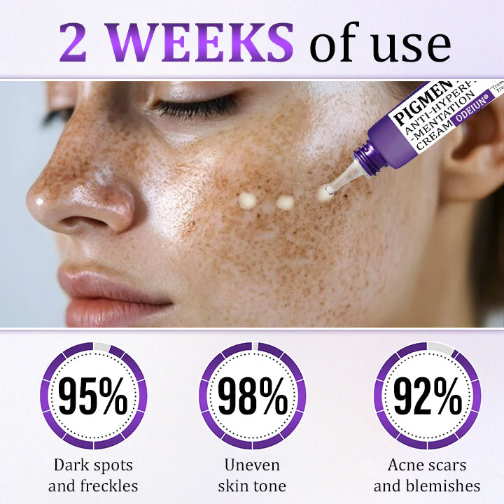ODEIUN® PigmentaX ProFade Anti-Hyperpigmentation Cream