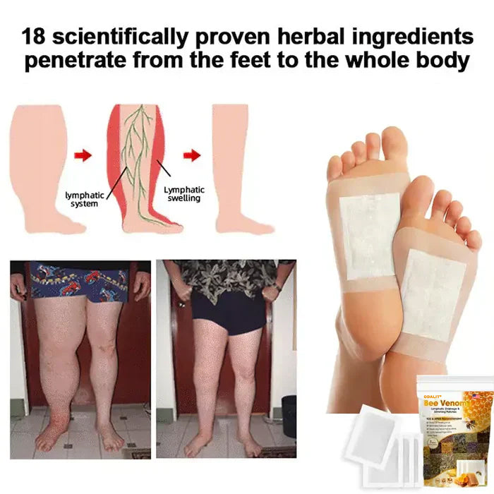 ODALIT® Natural Bee Toxin Detox Foot Patches: Slim Down & Relieve Aches (Plus Free Oil!)