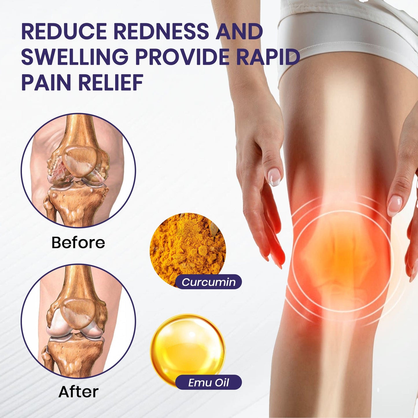 🔥Time-Limited Offer - ODALIT™  Turmeric & Emu Oil Arthritis Soothing Pain Relief Massage Gel