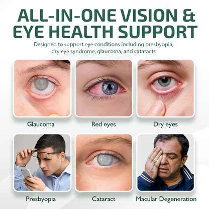 NEGUSY™ Nano Eye Drops Serum 👩‍⚕️ Royal College of Ophthalmologists Recommended (Suitable for presbyopia, dry eye syndrome, glaucoma, and cataracts)