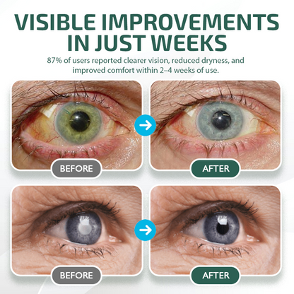NEGUSY™ Nano Eye Drops Serum 👩‍⚕️ Royal College of Ophthalmologists Recommended (Suitable for presbyopia, dry eye syndrome, glaucoma, and cataracts)