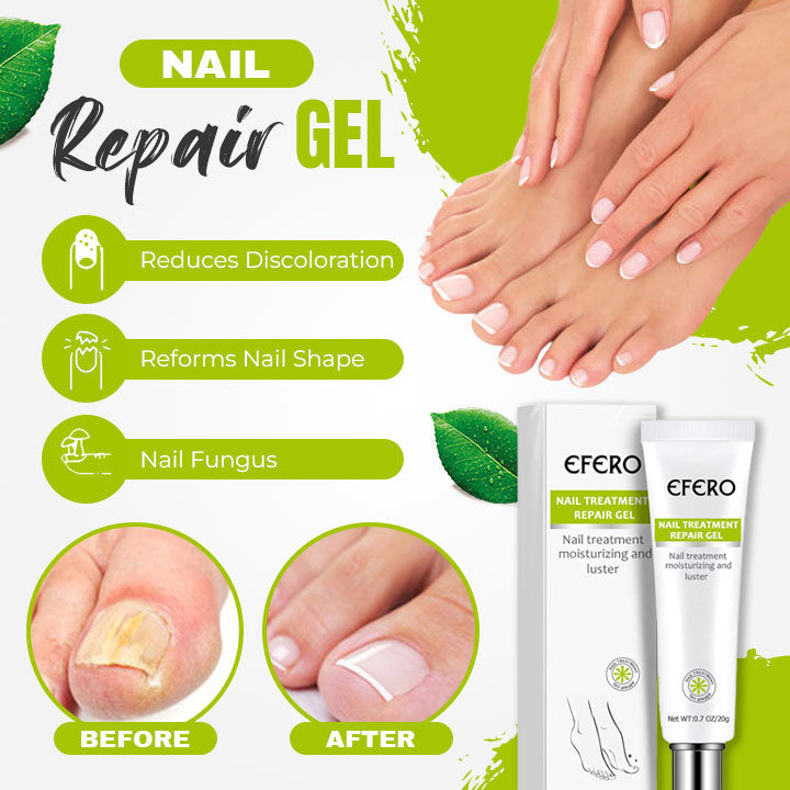 Nail 7 Days Treatment Gel