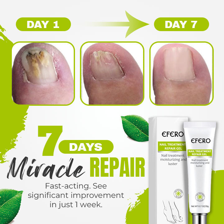 Nail 7 Days Treatment Gel
