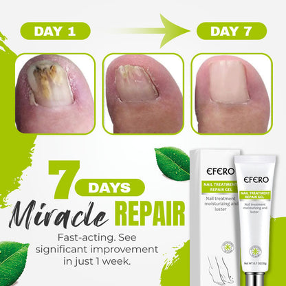 Nail 7 Days Treatment Gel