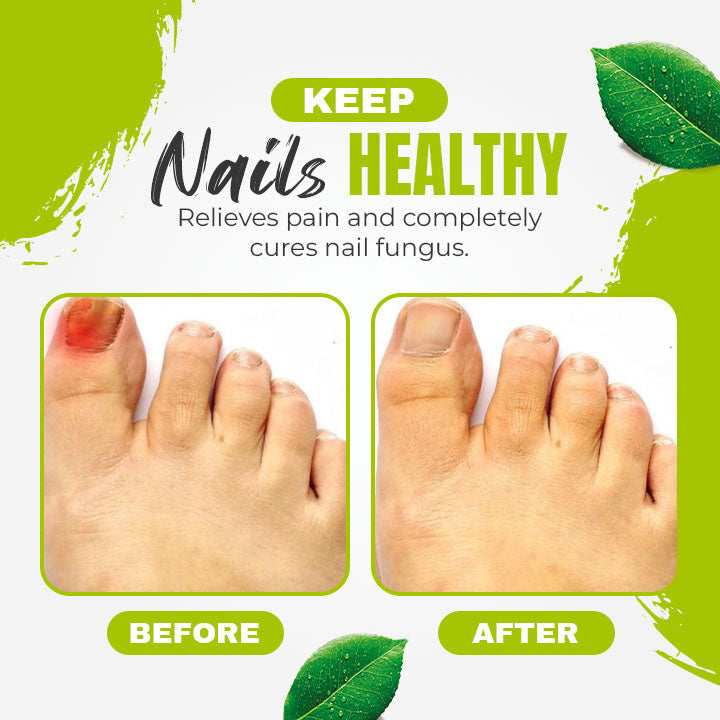 Nail 7 Days Treatment Gel
