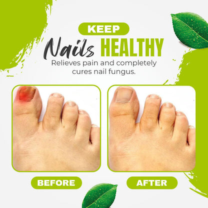 Nail 7 Days Treatment Gel