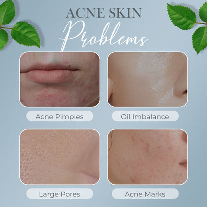 Tea Tree Anti-Acne Cream