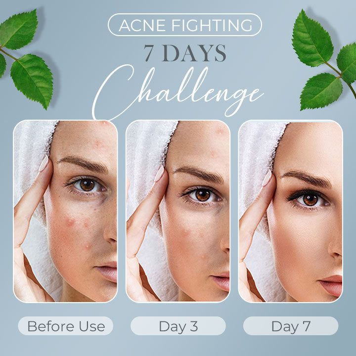 Tea Tree Anti-Acne Cream