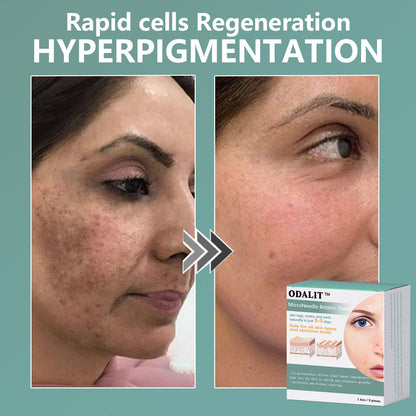 ✨ODALIT™ MicroNeedle Botanic skin Tag Removal Patch Made in the USA