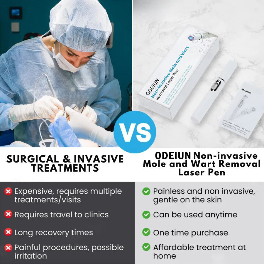 🔥【OFFICIAL STORE】ODEIUN™ Non-Invasive Mole and Wart Removal Laser Pen