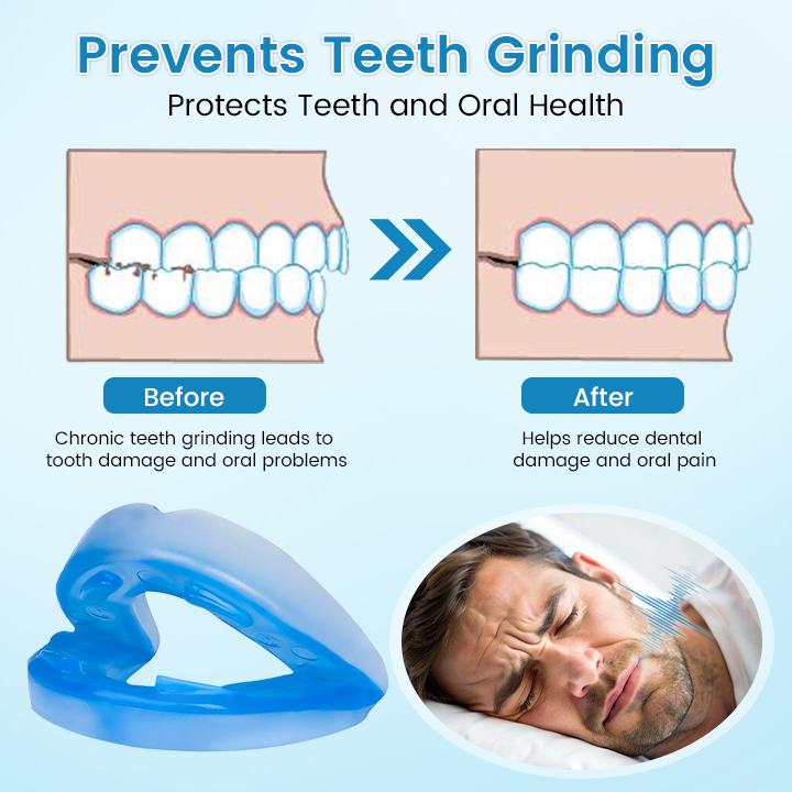 ✨[Official Brand Store] JEREMYTIS™ Adjustable Anti-Snoring Mouthpiece Universal Size