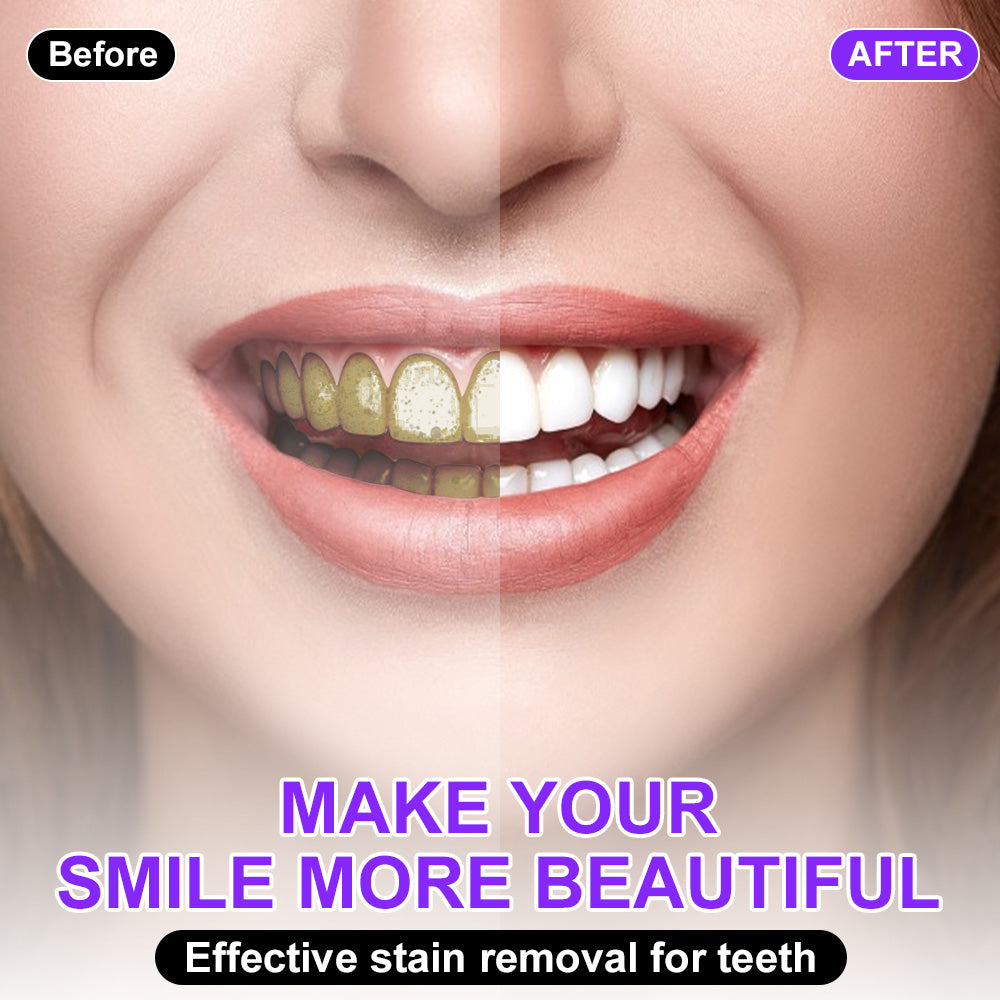 🦷𝐒𝐆𝐒 𝐔𝐊 𝐓𝐞𝐬𝐭𝐞𝐝 | NEGUSY® 𝐂𝐨𝐥𝐨𝐮𝐫 𝐂𝐨𝐫𝐫𝐞𝐜𝐭𝐨𝐫 𝐒𝐞𝐫𝐮𝐦 — Clinically proven to gently remove stains, whiten teeth, and restore natural brightness in just 3 days — safe for sensitive teeth and enamel