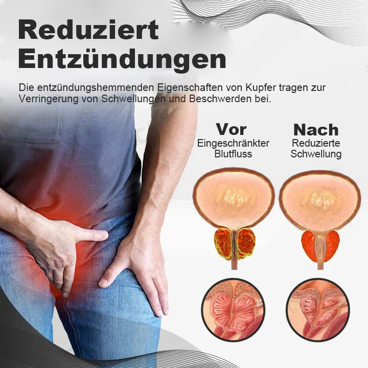 【✨Offizieller Markenshop ✨】Seurico™ Kupfer-Magnetisches Prostata-Therapiering (Zeitlich begrenzter Rabatt 🔥 Letzter Tag)