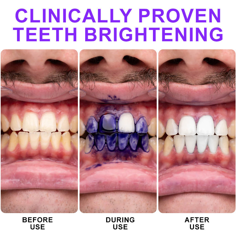 🦷𝐒𝐆𝐒 𝐔𝐊 𝐓𝐞𝐬𝐭𝐞𝐝 | NEGUSY® 𝐂𝐨𝐥𝐨𝐮𝐫 𝐂𝐨𝐫𝐫𝐞𝐜𝐭𝐨𝐫 𝐒𝐞𝐫𝐮𝐦 — Clinically proven to gently remove stains, whiten teeth, and restore natural brightness in just 3 days — safe for sensitive teeth and enamel