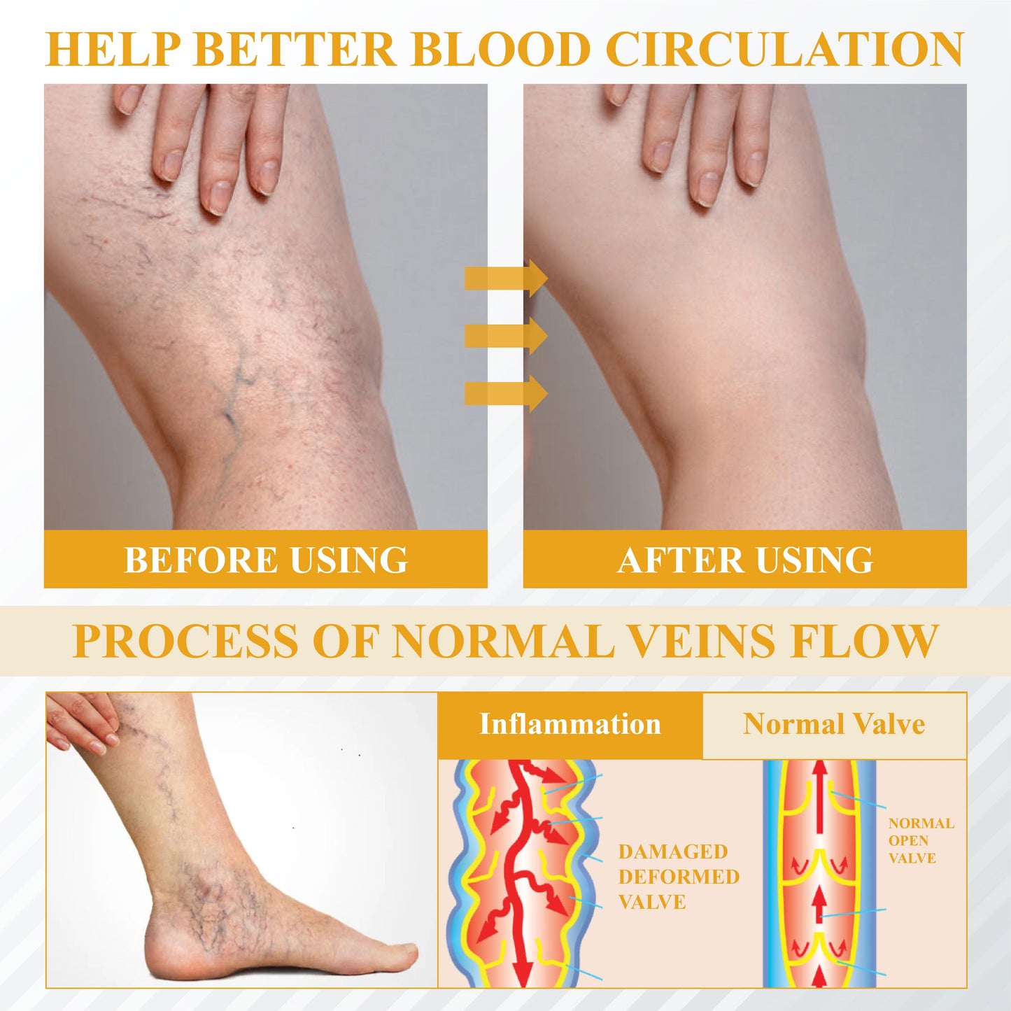 ODALIT® Bromelain Edema & Vein Care Cream