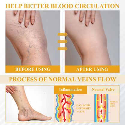 ODALIT® Bromelain Edema & Vein Care Cream