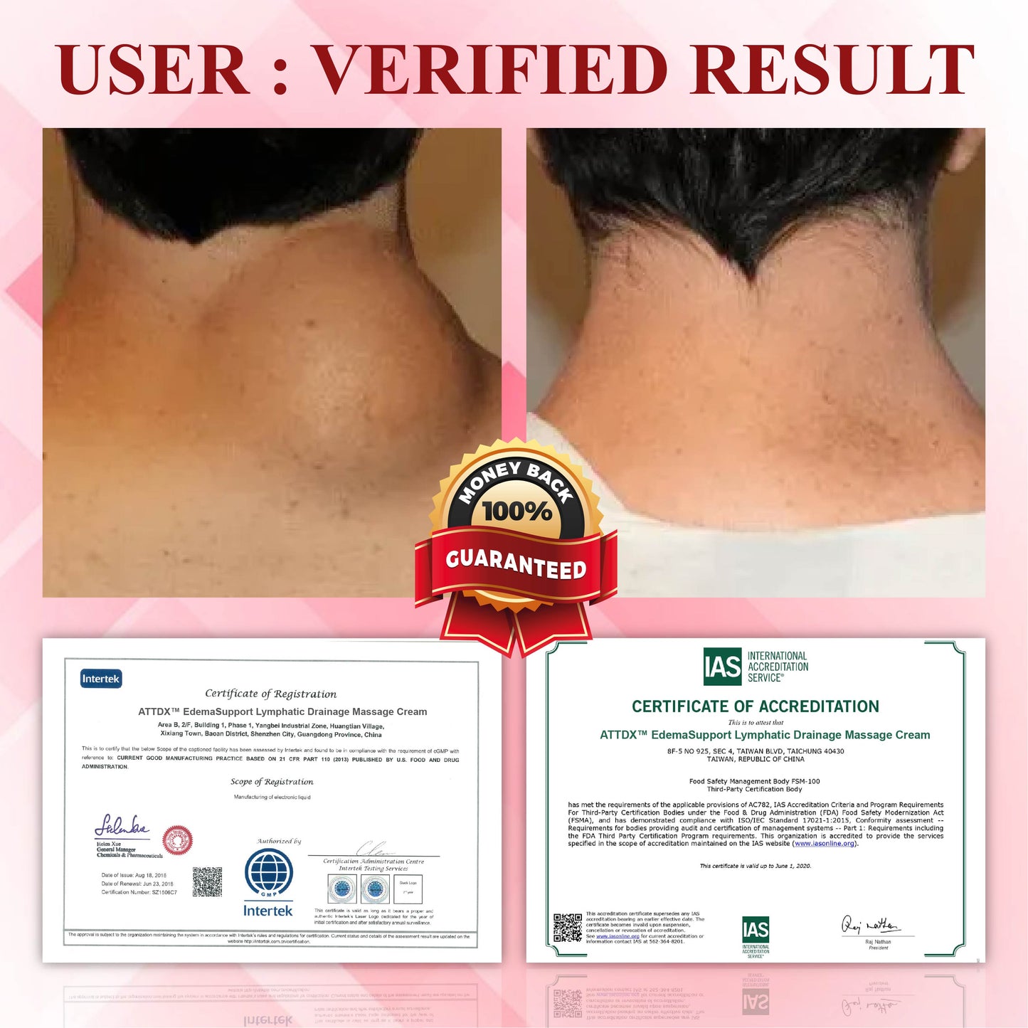 ODEIUN® EdemaSupport Lymphatic Drainage Massage Cream
