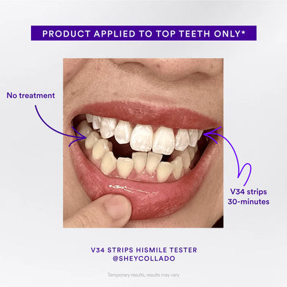 V34 Whitening Strips