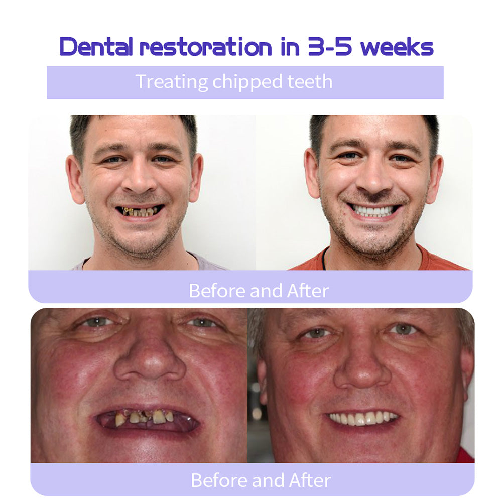 🔥 Final Day 50% OFF 🔥- Official Store💎 Fluoride-Free Hydroxyapatite Toothpaste