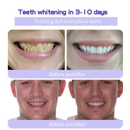 🔥 Final Day 50% OFF 🔥- Official Store💎 Fluoride-Free Hydroxyapatite Toothpaste