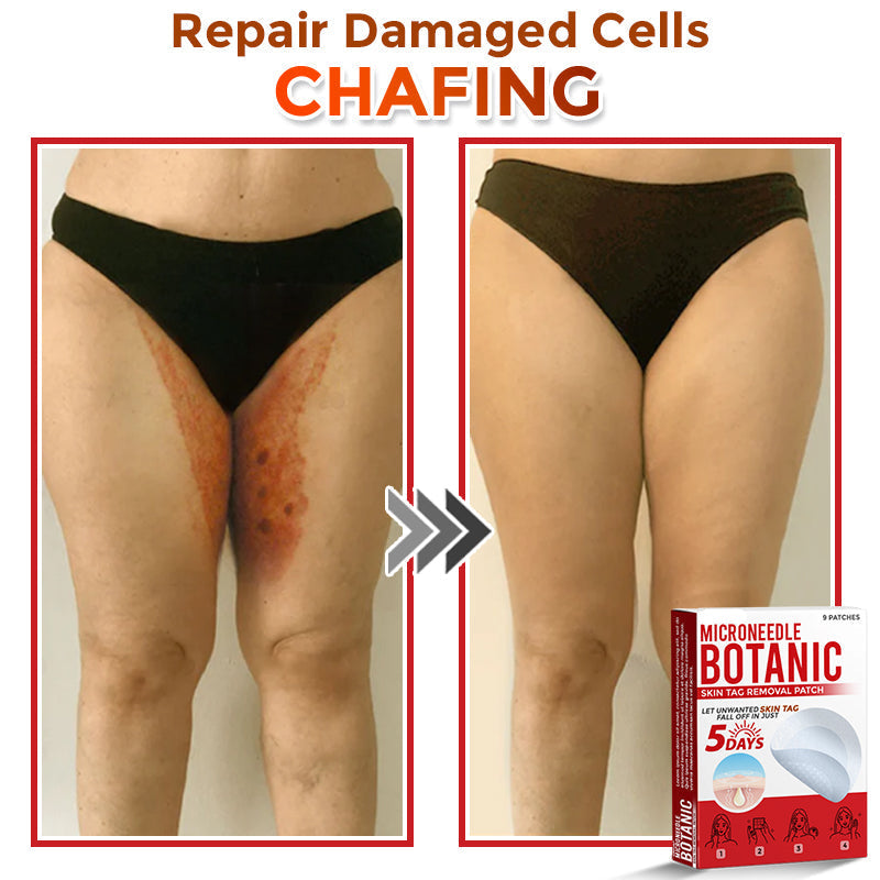 🌈MicroNeedle Botanic Skin Tag Removal Patch|Made in the USA