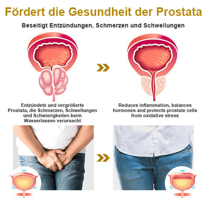 【✨Offizieller Markenshop ✨】Seurico™ Kupfer-Magnetisches Prostata-Therapiering (Zeitlich begrenzter Rabatt 🔥 Letzter Tag)