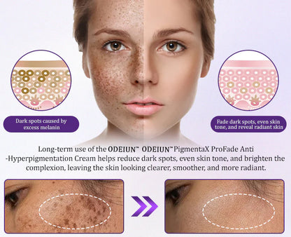 ODEIUN® PigmentaX ProFade Anti-Hyperpigmentation Cream