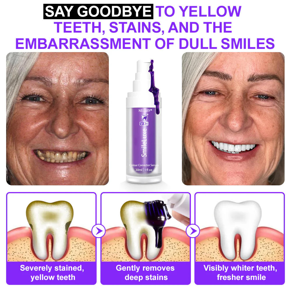 🦷𝐒𝐆𝐒 𝐔𝐊 𝐓𝐞𝐬𝐭𝐞𝐝 | NEGUSY® 𝐂𝐨𝐥𝐨𝐮𝐫 𝐂𝐨𝐫𝐫𝐞𝐜𝐭𝐨𝐫 𝐒𝐞𝐫𝐮𝐦 — Clinically proven to gently remove stains, whiten teeth, and restore natural brightness in just 3 days — safe for sensitive teeth and enamel