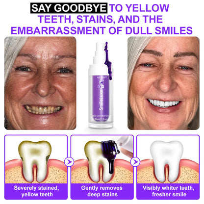 🦷𝐒𝐆𝐒 𝐔𝐊 𝐓𝐞𝐬𝐭𝐞𝐝 | NEGUSY® 𝐂𝐨𝐥𝐨𝐮𝐫 𝐂𝐨𝐫𝐫𝐞𝐜𝐭𝐨𝐫 𝐒𝐞𝐫𝐮𝐦 — Clinically proven to gently remove stains, whiten teeth, and restore natural brightness in just 3 days — safe for sensitive teeth and enamel